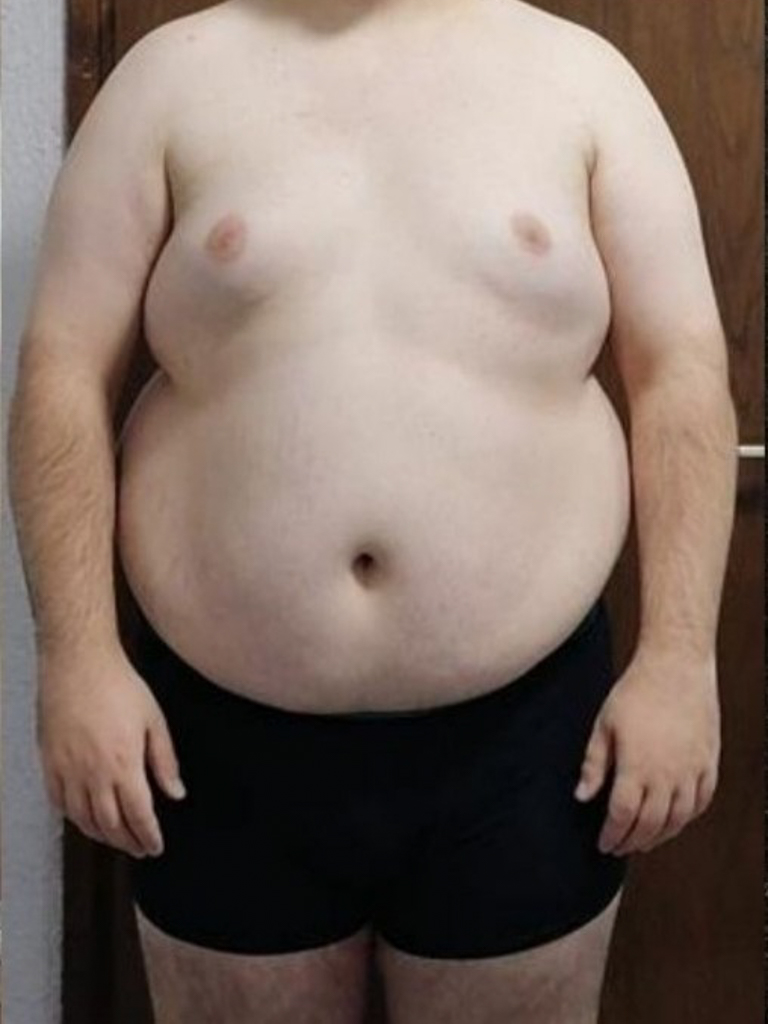 transformacija_tijela_definicija_Stefan_before